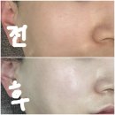 YJskincare | 울산 남구 스킨케어 잘하는 곳, 유진스킨케어에서 엑소가+mts 관리받았어요!