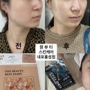 원뷰티스킨케어홍성