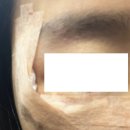 서초 서울 마더스 이미지