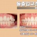 연세엘라인치과의원 네이버블로그