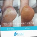 문제성발관리센터발을