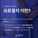 우비뇨기과의원 | 탕정비뇨기과, 요로결석 수술 피하려면 꼭 확인해야 정보