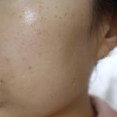 인셀덤 보네르 | 오산 인셀덤 - 인셀덤 보네르, 기초3종 세트 일주일 사용 리뷰