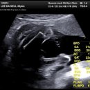 퀸스메디산부인과의원 | 임신 21주~22주 (정밀초음파, 입체초음파 예약시기 ) 공릉 퀸스메디 산부인과