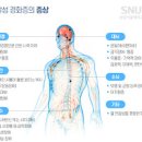 다발성 경화증 정리 이미지