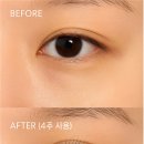 황후메디칼 | 진해 민생지원금 사용 가능한 [래쉬에딕트]에서 아름다움을 채워보세요.