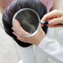 더스칼렛두피탈모센터