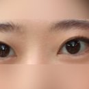 바이준성형외과의원 | 강남역 쌍수 성형외과병원 내돈내산 발품 상담후기(쌍커풀 재수술) - 일미리, 차이, 원더풀 성형외과