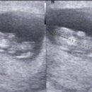 까망 곰 젤리 이미지