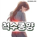 척수종양 원인 증상 치료 척수종양 생존율 및 치료법