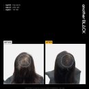 아인뷰티의원 이미지