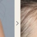 그렇게 갖고싶던 볼록한이마 드디어 갖게 되었네요~!!!