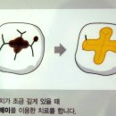 와온치과 네이버블로그