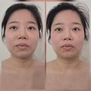 썬플뷰티 | 정관두골비윤곽관리받으러 썬플에스테틱 다녀왔어요!