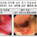 영전지 이미지