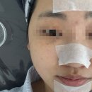 청라홈마트 | 청라피부관리 진짜 잘하는 새결에스테틱 1:1 맞춤관리 받고 온 후기