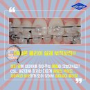 바른이안치과의원 네이버블로그