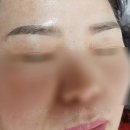 뷰티라썸