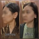 동신메디칼 | 영등포 피부관리 추천, 사운드바디사운드스킨 영등포 Organic 센터 더블임팩트 후기