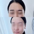 어니언소프트 | 명동왁싱 [어니언왁싱] 눈썹 & 인중왁싱 후기