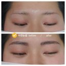 에프터유 이미지