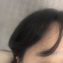 마이미의원 | 선릉 마이미의원 내돈내산 보톡스 후기