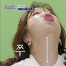 NO.1 자동차피부과 이미지