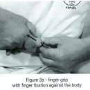 (1일차)실습-thumb traction manipulation(2가지) 이미지