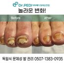 닥터페디(동래온천점) | 부산 장전동 발톱무좀 관리, 닥터페디 동래온천점에서 세심하게