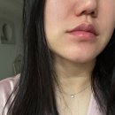 배곧피부과 리프팅 리프테라후기 엘뷰티의원 내돈내산