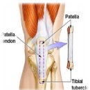 관절내시경- 무릎연골수술&무릎연골 이미지