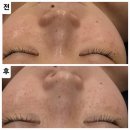 서윤피부맑음 수내점 | 광화문 피부관리 추천! 서윤피부맑음 명동점 만족후기