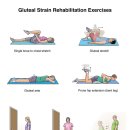 Gluteal Strain Rehabilitation Exercises 이미지