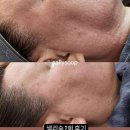 샐리네일