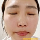 에이스리페어 이미지