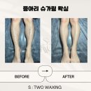 에스투왁싱