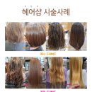 (주)콘디코리아 | 콘디 39클리닉 39크리닉 산열크리닉 성형복구클리닉