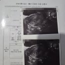 이정래산부인과의원 | [임신기록 ep.3] 평택 이정래산부인과 배란유도, 임신확인서 진단