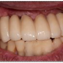 예플란트치과의원 이미지