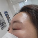 비에스프라임 | 광나루역 피부과 전문 병원 추천 좋아요 6곳