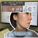 명스킨케어 - 달서구 | 휴가 전 피부관리 추천 | 구미압출 잘하는 루센트스킨 수박케어 솔직후기
