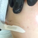 리즈 | 하남 미사 얼굴솜털제거 스킨플래닝 맛집 유어리즈 솔직후기