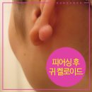 지디에스성형외과