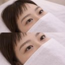 시연의원 | 압구정역 눈썹문신 입술문신 잘하는곳 반영구 뷰티센터 후기