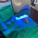 서울소담치과의원 | 청라 교정 치아미백 시림 통증 없음 서울삼성치과의원 방문 1회 후기