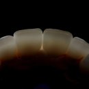 최신심미치과기공소 이미지