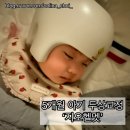 5개월 아기 두상교정 헬멧 귀 접힘, 피부 상처, 면 스타키넷 착용 후기 (4월의 지유 일상)