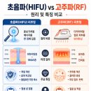 대한리프팅연구회 | 원장의 솔직 리포트] 초음파(HIFU) vs 고주파(RF) 리프팅, 내 얼굴형엔 뭐가 맞을까?(장비,가격,부작용)