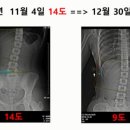 ﻿2021년 7월 11일(일) DMC재활운동학회 척추측만증 교정 교육 이미지