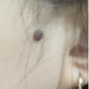 나비피부과의원 이미지